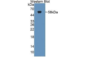 Western blot analysis of the recombinant protein. (Tenascin R anticorps  (AA 329-588))