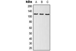 Western blot analysis of SNRP116 expression in HeLa (A), NIH3T3 (B), H9C2 (C) whole cell lysates. (EFTUD2 anticorps  (Center))