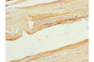 Immunohistochemistry of paraffin-embedded human skeletal muscle tissue using ABIN7175917 at dilution of 1:100 (xpr1 anticorps  (AA 529-696))