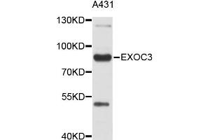 Western blot analysis of extracts of A-431 cells, using EXOC3 antibody (ABIN5999310).