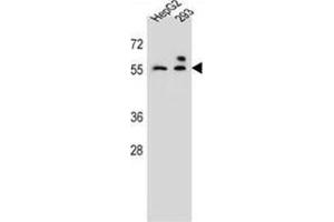 ZFP91 Antibody (Center) (AP54647PU-N ) western blot analysis in HepG2,293 cell line lysates (35 µg/lane). (ZFP91 anticorps  (Middle Region))