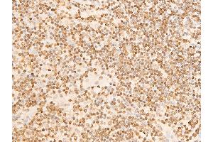ABIN6267301 at 1/100 staining human appendiceal tissue sections by IHC-P.