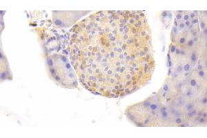 Detection of PKLR in Mouse Pancreas Tissue using Polyclonal Antibody to Pyruvate kinase isozymes R/L (PKLR)
