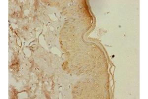 Immunohistochemistry of paraffin-embedded human skin tissue using ABIN7164417 at dilution of 1:100 (DTX2 anticorps  (AA 1-280))