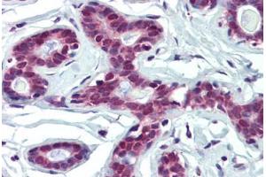 anti-Far Upstream Element (FUSE) Binding Protein 1 (FUBP1) (AA 540-589) antibody