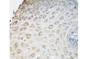 Immunohistochemistry of paraffin-embedded Human esophagus using GRPEL2 Polyclonal Antibody at dilution of 1:100 (40x lens).