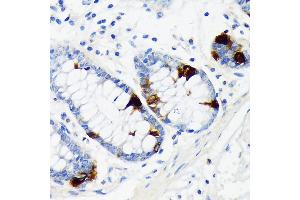 Immunohistochemistry of paraffin-embedded human colon using Chromogranin A Rabbit mAb (ABIN7266366) at dilution of 1:100 (40x lens). (Chromogranin A anticorps)