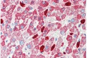 Human, Liver: Formalin-Fixed Paraffin-Embedded (FFPE)