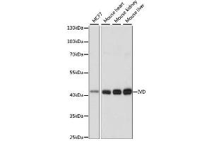 Western blot analysis of extracts of various cell lines, using IVD antibody. (IVD anticorps)