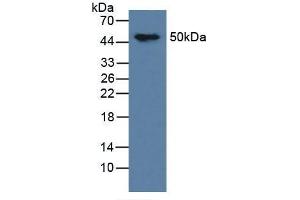 Figure. (tau anticorps  (AA 92-400))