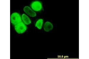 Image no. 2 for anti-Progesterone Receptor (PGR) (AA 1-111) antibody (ABIN598872) (Progesterone Receptor anticorps  (AA 1-111))