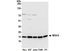 anti-Ribosomal Protein S15 (RPS15) (AA 95-145) antibody