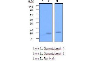 The recombinant Synaptobrevin 1,2(each 20ng) and the extracts of Rat brain(20 ug) were resolved by SDS-PAGE, transferred to PVDF membrane and probed with anti-human Synaptobrevin 2 (1:2,000). (VAMP2 anticorps  (AA 1-89))