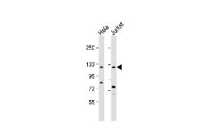 All lanes : Anti-SRG Antibody (C-term) at 1:2000 dilution Lane 1: Hela whole cell lysate Lane 2: Jurkat whole cell lysate Lysates/proteins at 20 μg per lane. (SRGAP3 anticorps  (C-Term))