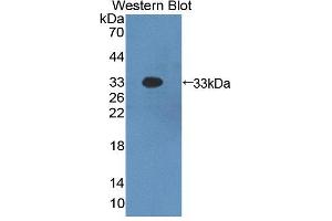 Western blot analysis of the recombinant protein. (SP100 anticorps  (AA 116-333))