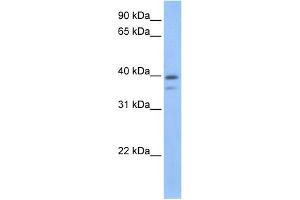 VPS26B antibody used at 1 ug/ml to detect target protein. (VPS26B anticorps)