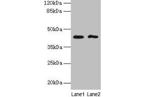 Western blot All lanes: BTBD2 antibody at 6 μg/mL Lane 1: Hela whole cell lysate Lane 2: MDA-MB-231 whole cell lysate Secondary Goat polyclonal to rabbit IgG at 1/10000 dilution Predicted band size: 56, 23 kDa Observed band size: 42 kDa (BTBD2 anticorps  (AA 321-525))