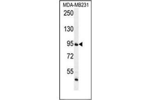Western blot analysis of FTSJ3 Antibody (Center) in MDA-MB231 cell line lysates (35ug/lane).