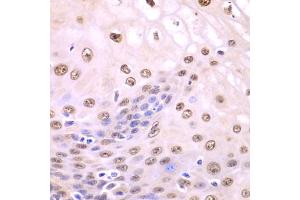 Immunohistochemistry of paraffin-embedded human esophagus using SQSTM1 antibody. (SQSTM1 anticorps)