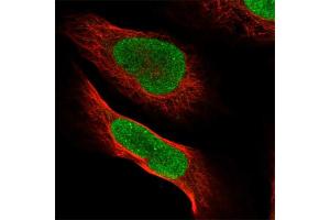 Immunofluorescent staining of human cell line U-2 OS with PVRL1 polyclonal antibody  at 1-4 ug/mL concentration shows positivity in nucleus but excluded from the nucleoli. (PVRL1 anticorps)