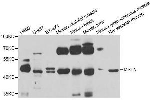 Western blot analysis of extracts of various cell lines, using MSTN antibody. (MSTN anticorps  (AA 267-375))