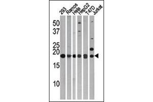 LC3C Antibody (APG8c) Cat. (LC3C anticorps  (N-Term))
