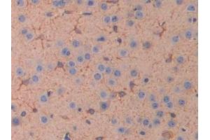 Detection of IL11Ra in Mouse Cerebrum Tissue using Polyclonal Antibody to Interleukin 11 Receptor Alpha (IL11Ra) (IL11RA anticorps  (AA 59-217))