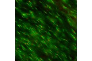 Adult rat optic nerve immunofluorescence staining K87A/10=red Rabbit anti-Caspr=green Image courtesy of Dr.