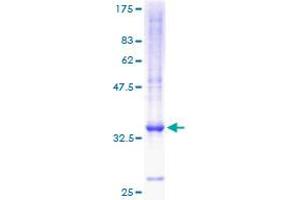 Chemokine (C-X-C Motif) Ligand 5 (CXCL5) (AA 1-114) protein (GST tag)