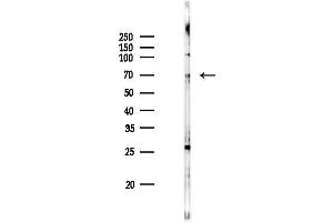 anti-Acyl-CoA Synthetase Short-Chain Family Member 1 (ACSS1) (C-Term) antibody
