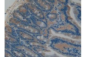DAB staining on IHC-P; Samples: Rat Intestine Tissue (PLAT anticorps  (AA 311-487))