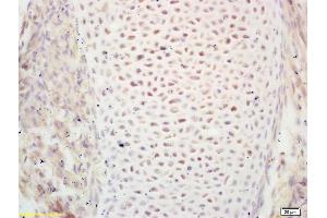 Formalin-fixed and paraffin embedded mouse embryo labeled with Rabbit Anti PIWIL1/Miwi Polyclonal Antibody, Unconjugated (ABIN671631) at 1:200 followed by conjugation to the secondary antibody and DAB staining