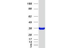 Validation with Western Blot