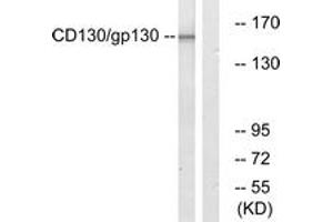 Western blot analysis of extracts from Jurkat cells, using CD130/gp130 (Ab-782) Antibody. (CD130/gp130 anticorps  (AA 748-797))