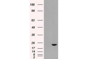 Image no. 1 for anti-Adenylate Kinase 1 (AK1) antibody (ABIN1496514) (Adenylate Kinase 1 anticorps)