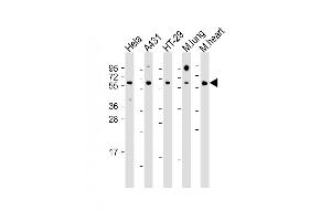 All lanes : Anti-CDC25B Antibody (Center) at 1:1000 dilution Lane 1: Hela whole cell lysate Lane 2: A431 whole cell lysate Lane 3: HT-29 whole cell lysate Lane 4: mouse lung lysate Lane 5: mouse heart lysate Lysates/proteins at 20 μg per lane.