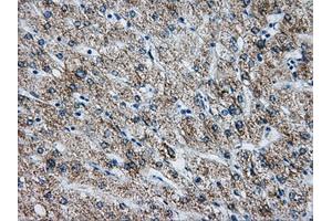 Immunohistochemical staining of paraffin-embedded liver tissue using anti-ATP5B mouse monoclonal antibody. (ATP5B anticorps)