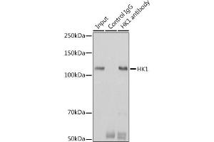 Immunoprecipitation analysis of 600 μg extracts of Mouse brain cells using 3 μg HK1 antibody (ABIN7267638).