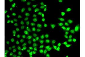Immunofluorescence analysis of A-549 cells using E antibody (ABIN6127826, ABIN6139905, ABIN6139906 and ABIN6222933). (EAF2 anticorps  (AA 1-170))