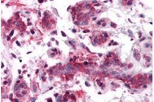 anti-R-Spondin 1 (RSPO1) (N-Term) antibody