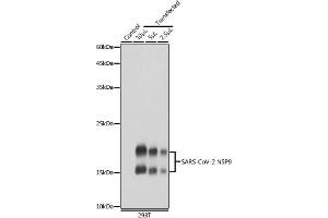 Western blot analysis of extracts of normal 293T cells and 293T transfected with NSP9 Protein, using SARS-CoV-2 NSP9 antibody (ABIN7268509) at 1:5000 dilution. (MHV NSP9 anticorps)