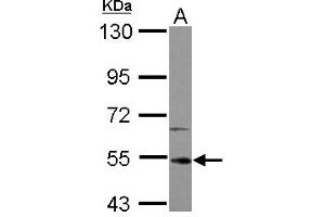 Image no. 2 for anti-Interleukin-1 Receptor-Associated Kinase 4 (IRAK4) (AA 27-288) antibody (ABIN1498897) (IRAK4 anticorps  (AA 27-288))