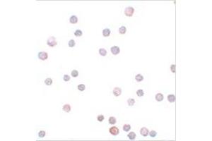 Immunocytochemistry of ZEB1 in HeLa cells with ZEB1 antibody at 20 μg/ml.
