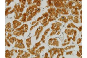 Immunoperoxidase of monoclonal antibody to MFN2 on formalin-fixed paraffin-embedded human heart.