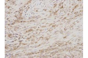Immunohistochemistry (IHC) image for anti-Thymopoietin (TMPO) antibody (ABIN1875122) (Thymopoietin anticorps)