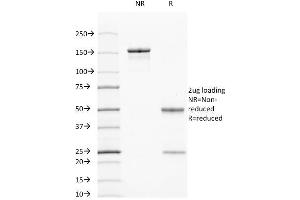 SDS-PAGE Analysis Purified Cytokeratin 7/17 Mouse Monoclonal Antibody (C-46). (Keratin 7/17 anticorps)