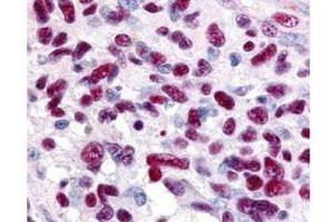 Immunohistochemistry of Rabbit anti-Gli-3 antibody.