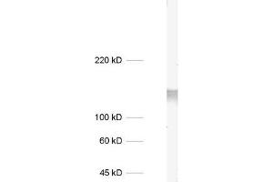 dilution: 1 : 1000, sample: mouse brain homogenate (STXBP5L anticorps)