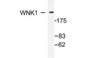 Image no. 1 for anti-WNK Lysine Deficient Protein Kinase 1 (WNK1) antibody (ABIN271862) (WNK1 anticorps)
