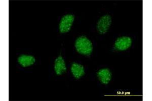 Immunofluorescence of purified MaxPab antibody to ZNF486 on HeLa cell. (ZNF486 anticorps  (AA 1-216))